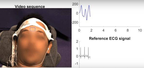 C’est la caméra qui analyse désormais respiration et